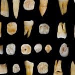Adieu plombages et couronnes ?…. Les dents pourraient un jour pousser en laboratoire